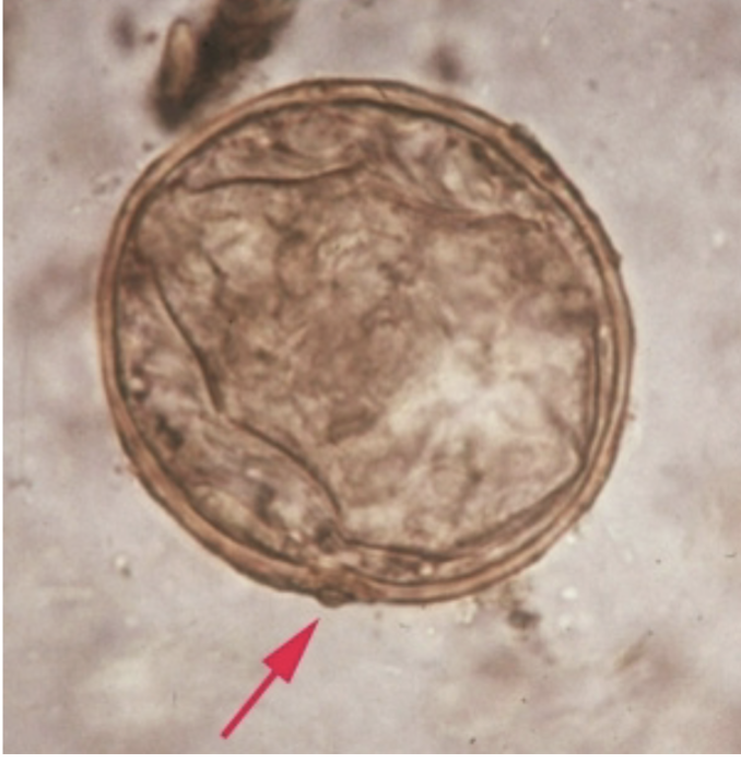 <p>-Eggs are around 80 microns long</p><ul><li><p>Inconspicuous “spine”</p></li></ul><p></p>