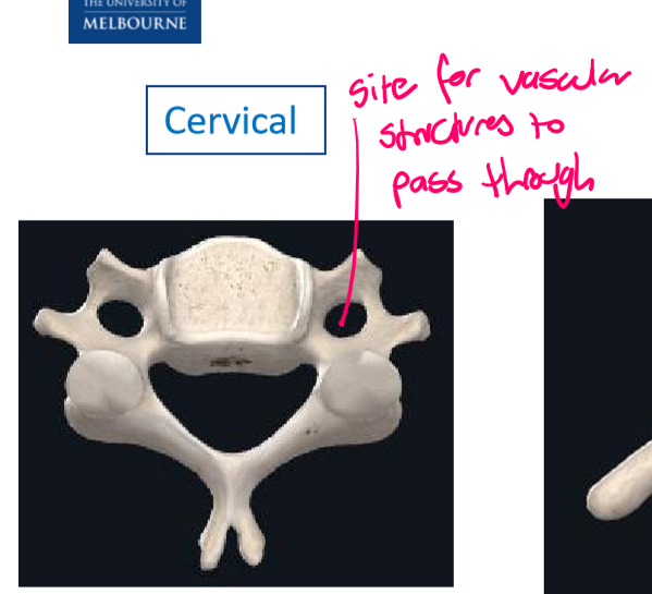 <p>‘Eyes’ in the vertebral column = site for vascular structures to pass through</p><p></p>