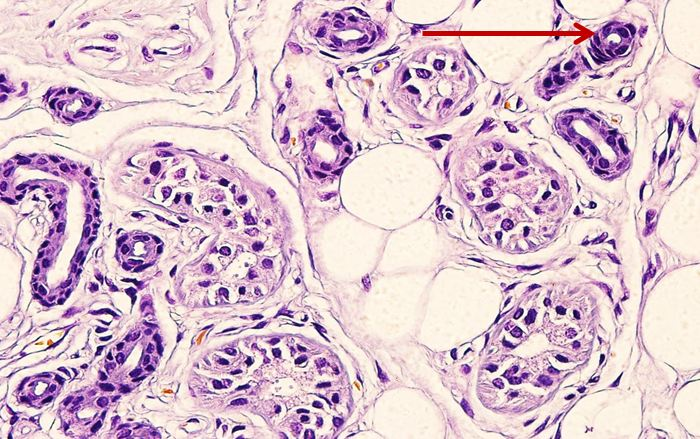 <p>Biểu mô gì ?</p>