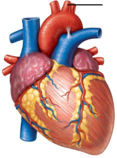 <p><span style="line-height: 17.375px;">Identify the blood vessel shown here.&nbsp;</span></p>