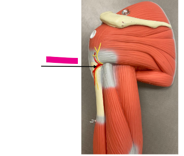 <p>What is the pink arrow?</p>