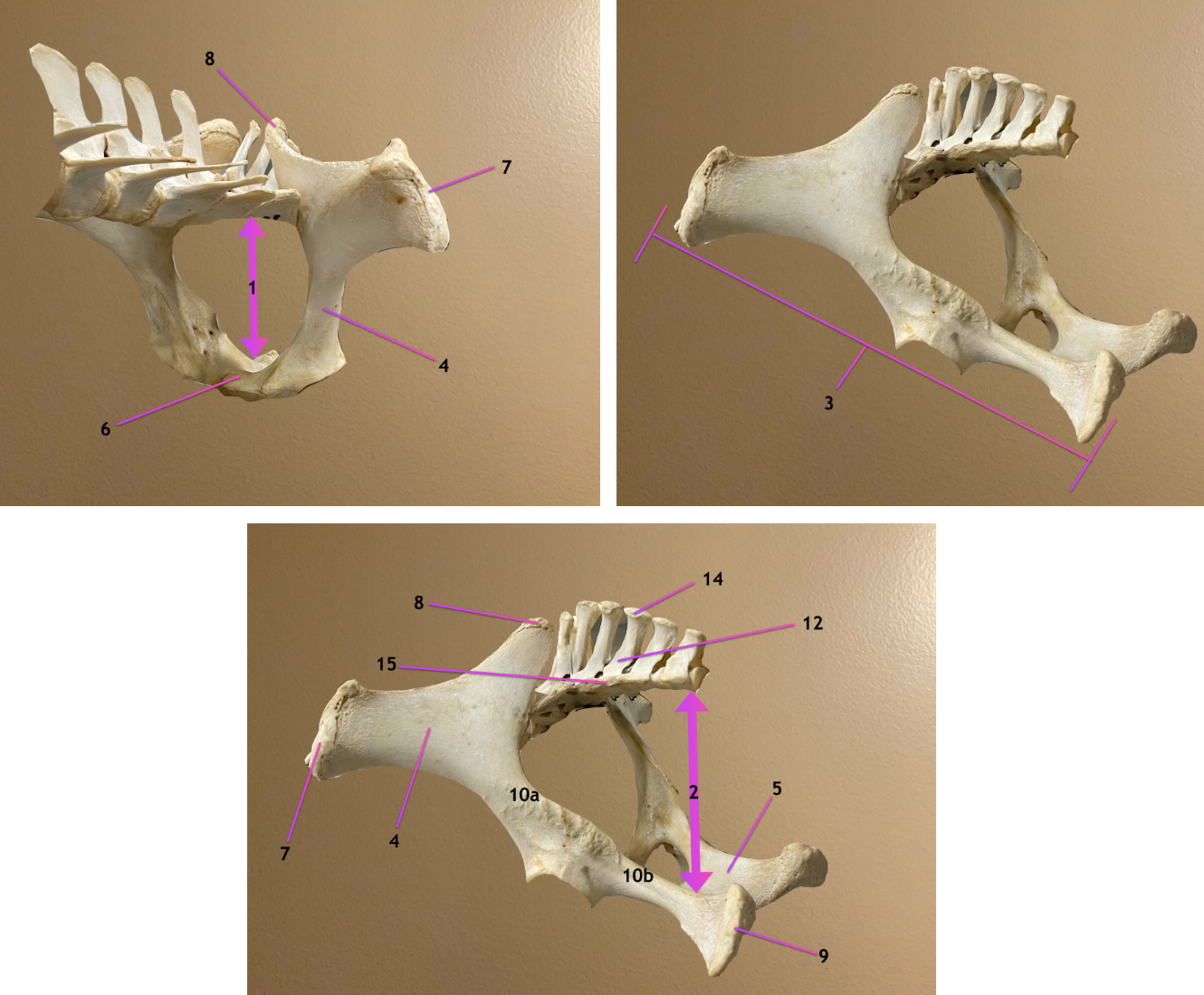 <p>pic 1: cranial to cd view of pelvis &amp; lumbar spine</p><p>pic 2/3: caudolateral view of pelvis</p><p>.</p><p>label 9, 10a, 10b</p>