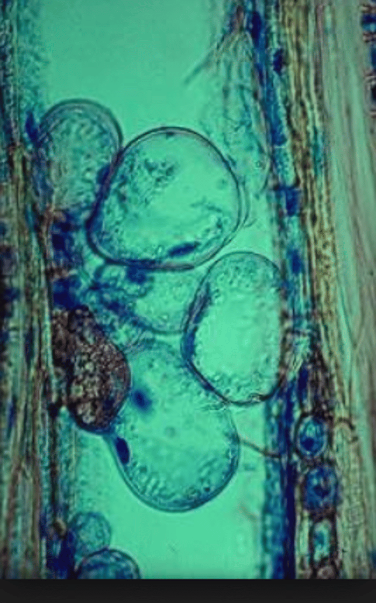 <p>A physical plant defence that forms a swelling that fills xylem vessels, preventing the flow of water, stopping the spread of infection. Also contains anti-pathogen chemicals</p>