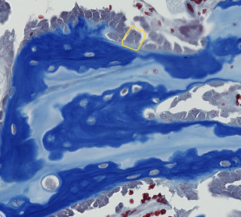 <p>what is the name of the unmineralized matrix of collagen type I and proteoglycans secreted bu the encircled bone cell?</p>