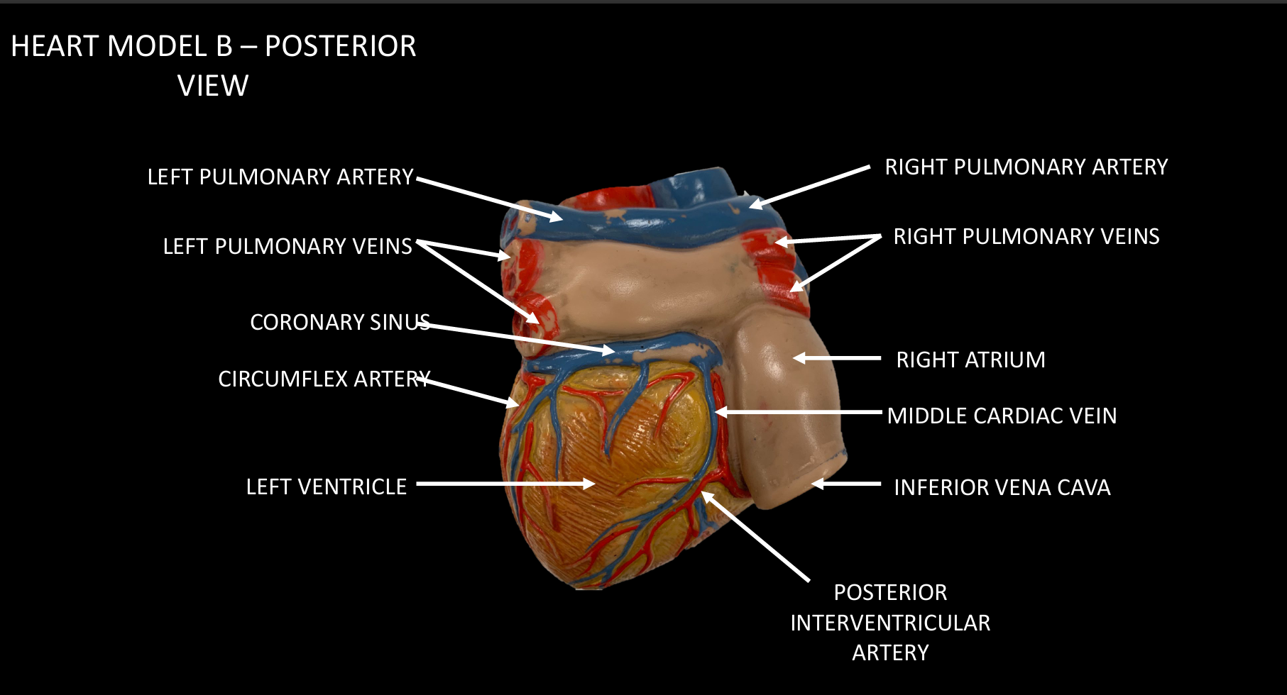 <p>POSTERIOR INTERVENTRICULAR ARTERY</p>