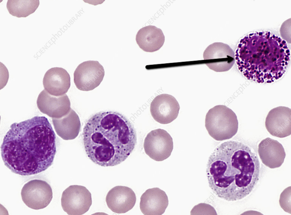 <p><span><strong>Identify the blood cell indicated by the pointer.</strong></span></p>