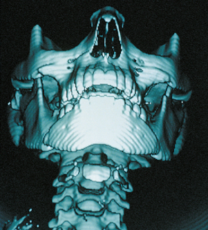 <p>Computer-analyzed x-ray images.</p>