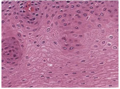 <p>epithelial tissue</p>