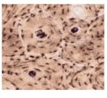 <p>Consists of osteocytes sitting in lacunae cavities surrounded by layers of a very hard matrix with very few cells</p>