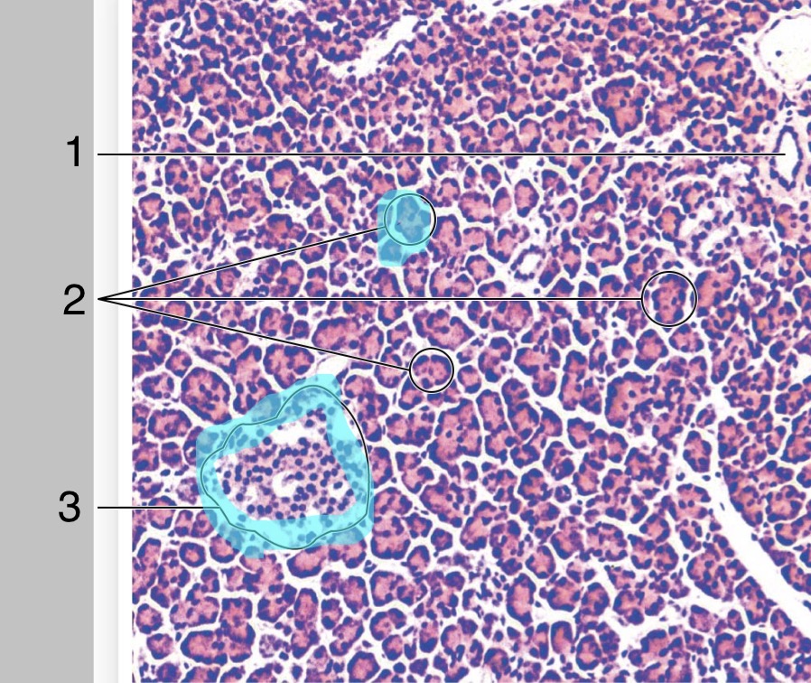 <p>Identify the regions of the Pancreas (histology)</p>