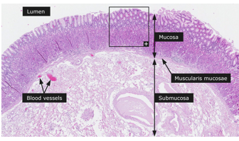 <p>layers of the esophagus innermost → outermost</p>