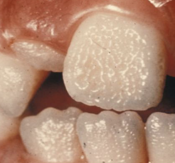 <p>what type of AI?</p>