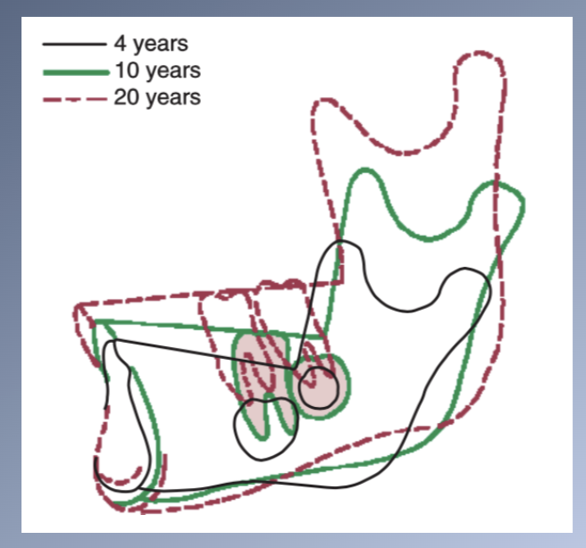 <p>Mandible</p><p><span>During the time that the core of the Mn rotates forward +15º à Mn plane angle decreases only 2-4º due to SURFACE CHANGES that tend to compensate</span></p><p><span>Areas of change</span><br><span>1. Posterior part of the lower border of the mandible = area of resorption</span><br><span>2. Anterior aspect of the lower border is unchanged/slight apposition</span></p>