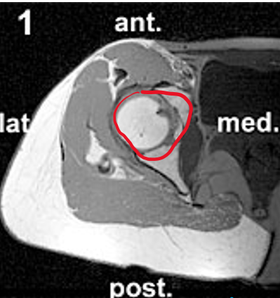 term image