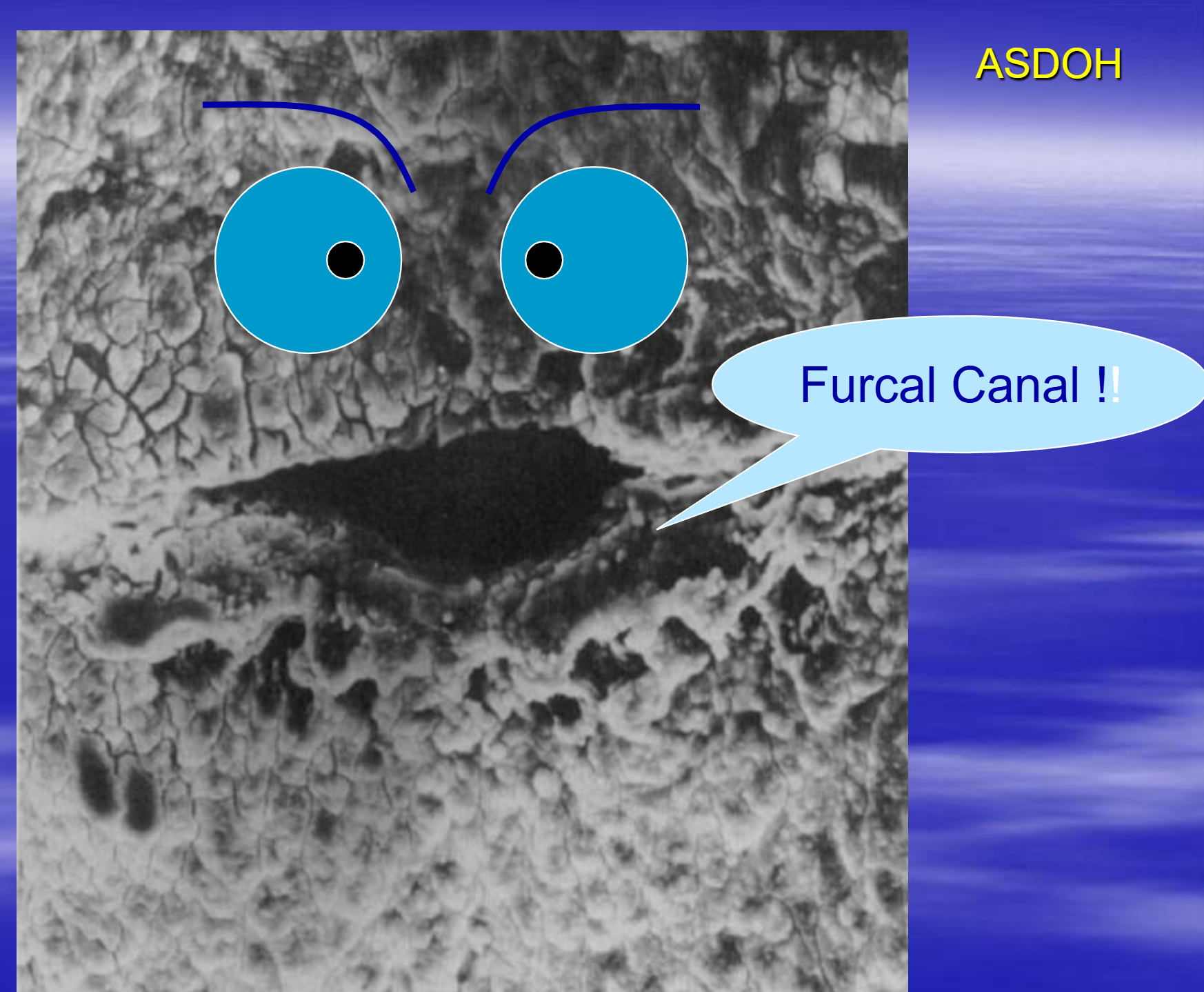 <p><b>Furcal canal</b></p>