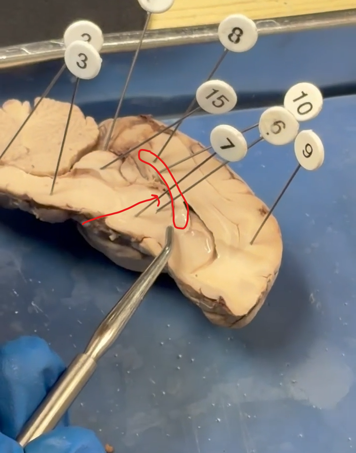 <p>Midline Cut: Structure?</p>