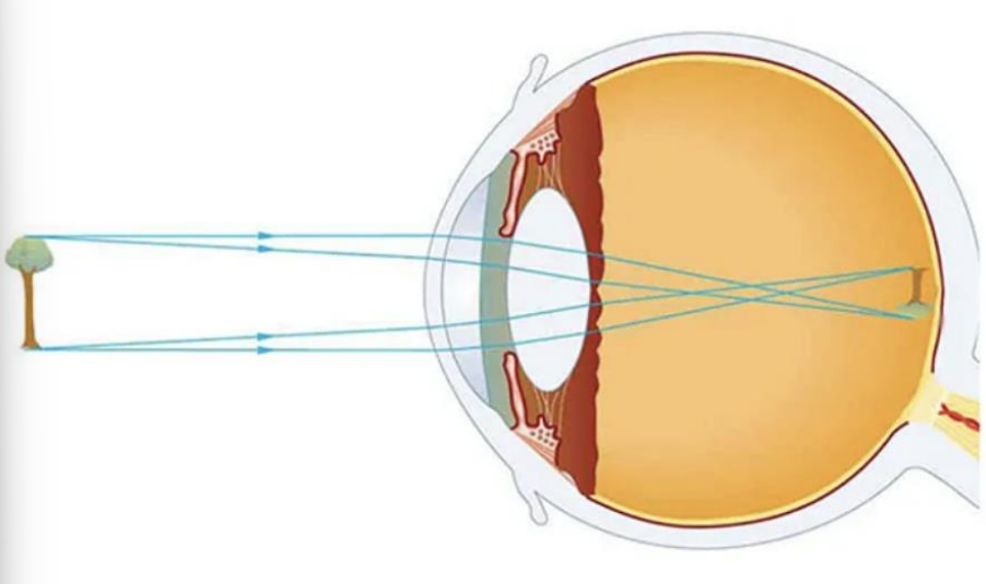 <p>ribaltate sulla fovea centrale </p>
