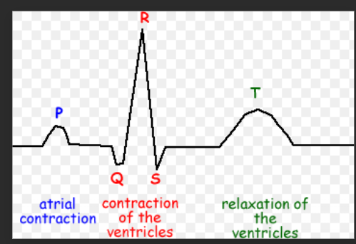 <p>P = atrial systole - SA node generates a wave of excitation which passes across the atrial walls leading to atrial systole </p><p>Q, R and S = Ventricular systole - wave of excitation passes down the bundle of his and up the Purkyne fibres in the walls leading to ventricular systole </p><p>T= diastole - both atria and ventricles contract leading to diastole </p><p>Then there is a refractory period after contraction which means that the heart is unable to contract for a brief time </p>