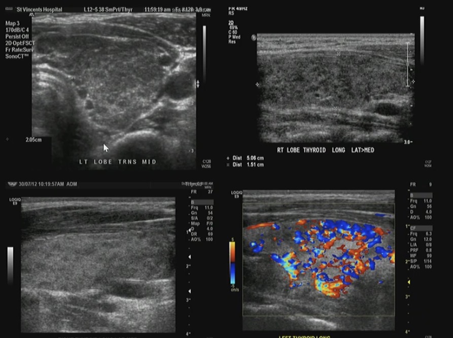term image