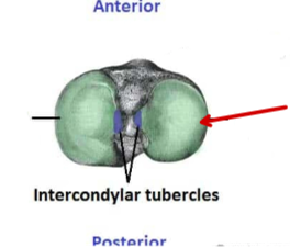 <p>Tibia</p>