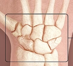 term image