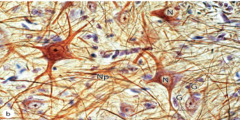 <p>- Dense network of nerve fibers and their branches/synapses, together with glial processes</p>