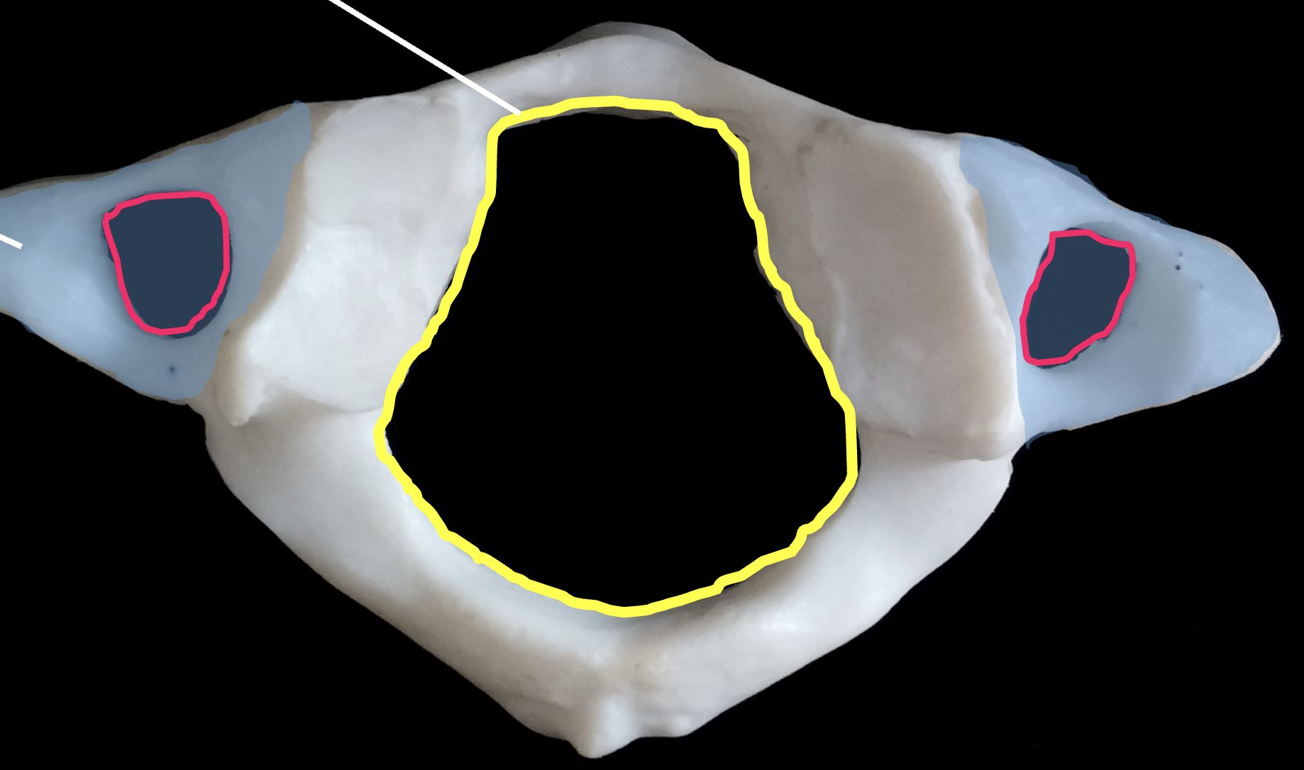 <p>What is the red region highlighted on C1, atlas?</p>
