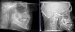 <p>Left vs. right</p>