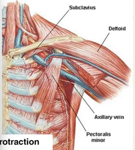 <p>Medial pectoral nerve (branches will pierce pectoralis minor to innervate pectoralis major) </p>