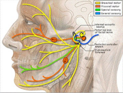 <p>suggests facial nerve transection</p><p>requires immediate consultation with maxillofacial surgery</p>