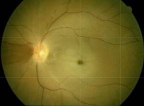 <p>Segmentation</p>