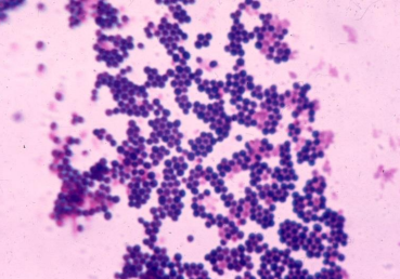 <p>PATHOGENIC BACTERIA:</p>