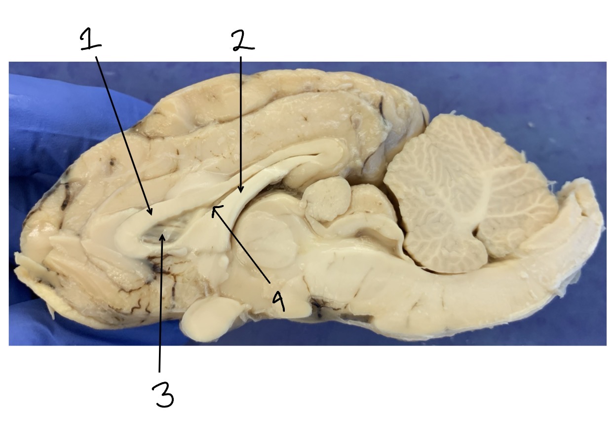 <ol start="4"><li><p>Space</p></li></ol><p></p>