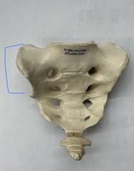 <p>What is the arrow pointing to?</p>