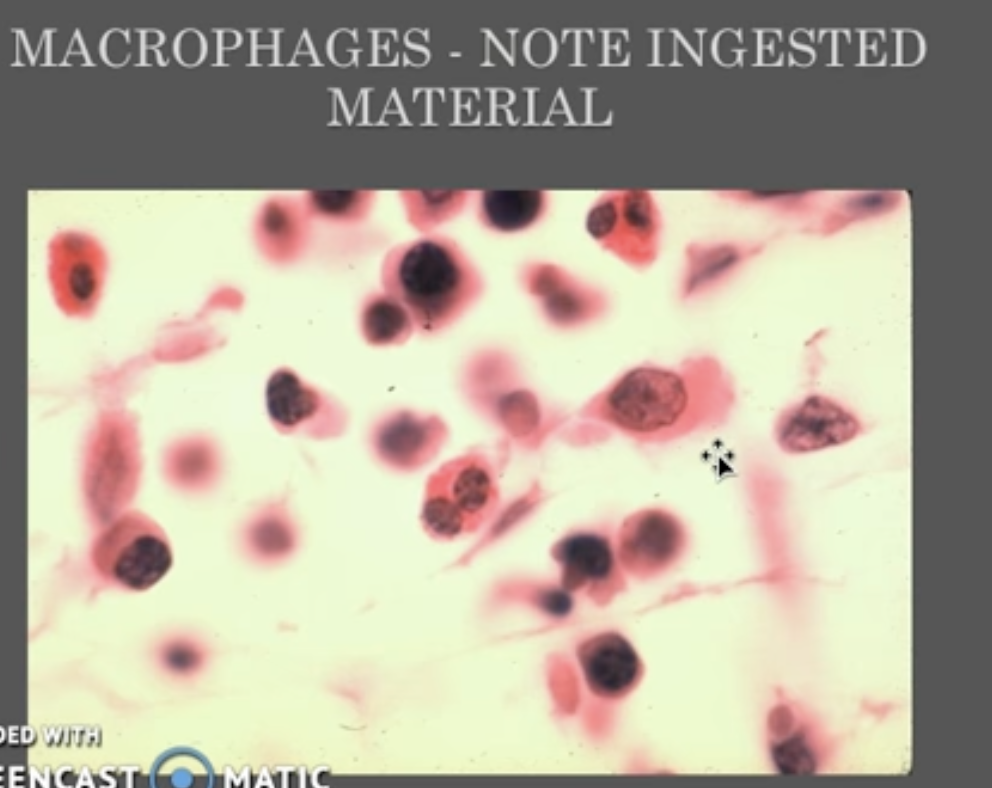 <ul><li><p>eat pathogens and cellular debris, helping to protect the body from infection and facilitating tissue repair. </p></li><li><p>type of immune cell that play a key role in allergic reactions and defense against pathogens by releasing histamine and other chemicals. </p></li><li><p>specialized cells that make collagen, providing structural support to tissues. </p></li></ul><img src="https://assets.knowt.com/user-attachments/91759acd-80aa-4564-8b9b-75898d1fbfbb.png" data-width="50%" data-align="center"><img src="https://assets.knowt.com/user-attachments/725435b0-266c-4ae9-872c-6462843e1a1f.png" data-width="50%" data-align="center"><p></p>