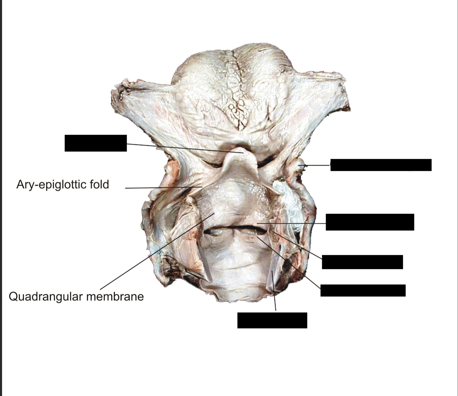 term image