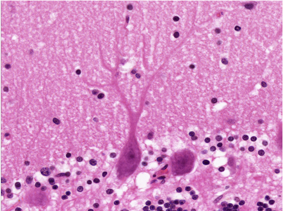 <p>• Location is in the cerebellum.</p><p>• Master coordinator of voluntary movement, balance, motor learning</p>