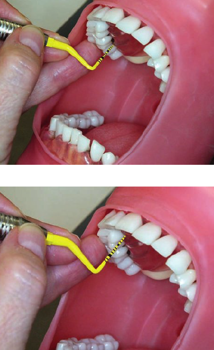 <ul><li><p>3 o’ clock position</p></li><li><p>Chin up</p></li></ul><p></p><p><strong>Mirror use</strong></p><ul><li><p>Use mirror to view the distal surfaces of the teeth </p></li></ul><p></p><ol><li><p><strong>Second molar, lingual aspect</strong></p></li></ol><ul><li><p>Finger rest on the occlusalfacial line angle</p></li></ul><p></p><ol start="2"><li><p><strong>First premolar, lingual aspect</strong></p></li></ol><ul><li><p>Finger rest on occlusofacial line angle or incisal edge </p></li></ul><p></p>