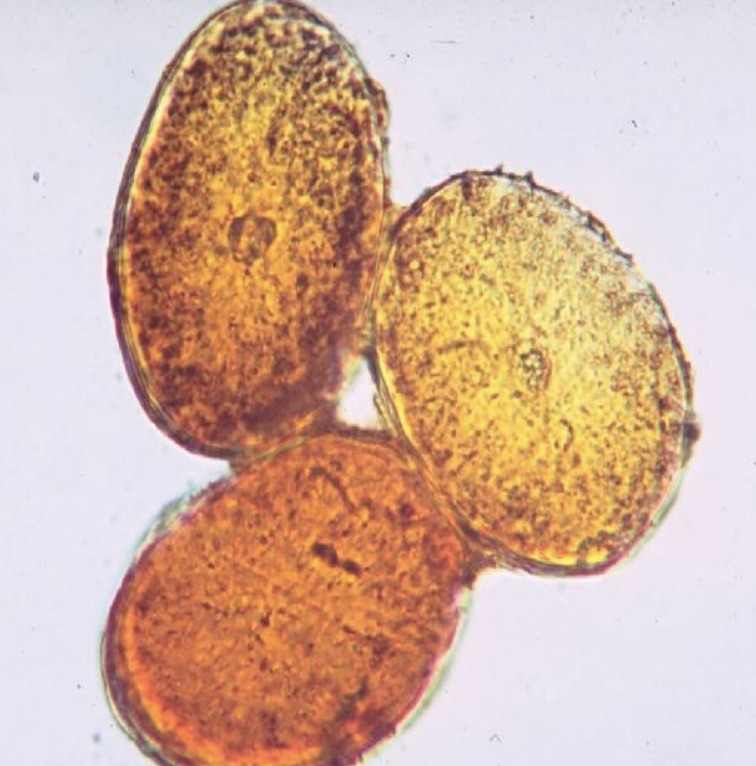<p>cross section</p>