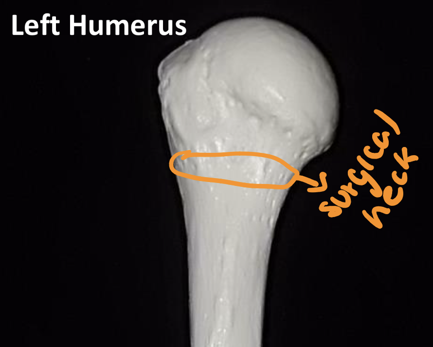 <p>Surgical neck (humerus proximal end) </p>