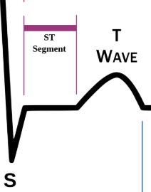 <p>end of S to start of T wave</p>