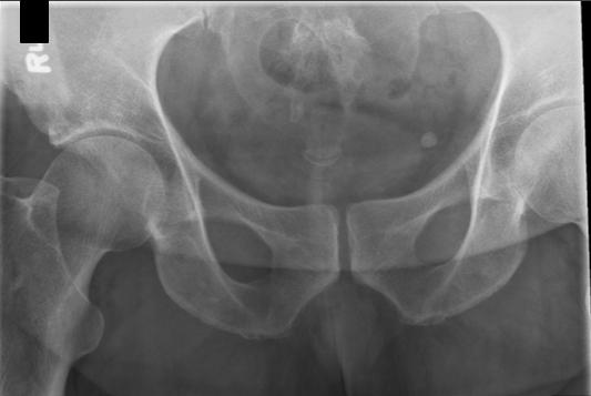 <p>critique coccyx AP axial </p>