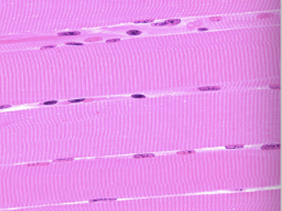 <p>striated cells, voluntary multinucleate</p>