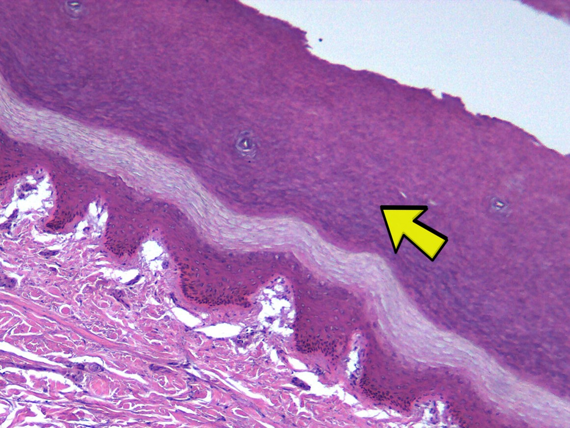 <p>Identify the specific <strong>REGION</strong> of the skin in the micrograph at the yellow arrow</p>