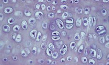 <p>Hyaline cartilage </p>