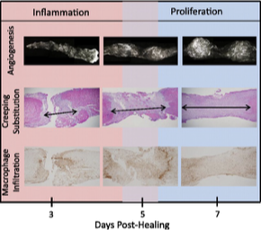 <p>haemorrhage</p><p>proliferative phase</p><p>remodelling </p>