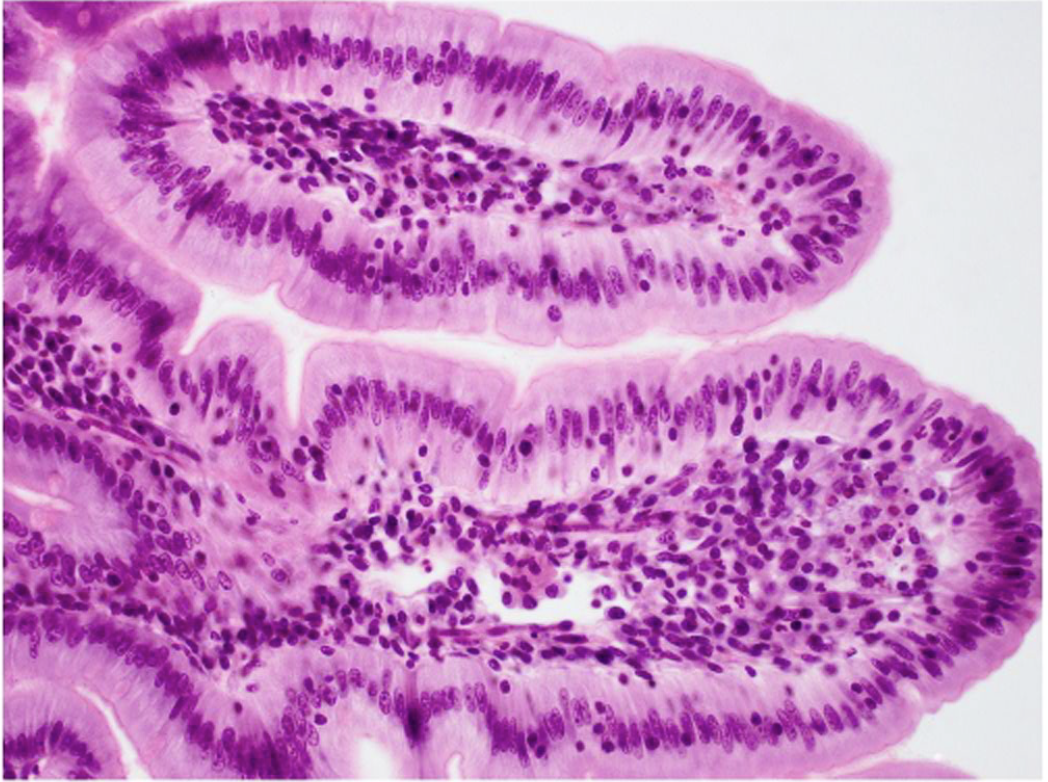<p>One layer of tall and narrow cells in columns, nuclei are narrow and elongated, cells are tightly packed, goblet cells are scattered around column (lighter).</p>