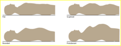 <p>1. Flat</p><p>2. Scaphoid: Sunken Anterior Wall (maybe patient is anorexic or did not eat)</p><p>3. Rounded: slightly distended</p><p>4. Protuberant: Distended (maybe patient is pregnant)</p>