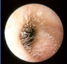 <p>-many hairs (trpas dust etc) </p><p>-has ceruminous glands that secrete bactericidal wax (prevents bacteria developing) </p><p>-has sabaceous glands </p>