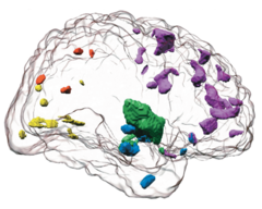 <p>cognitive growth (n. phrase) /ˈkɒɡnətɪv ɡrəʊθ/ the development of thinking and understanding</p>